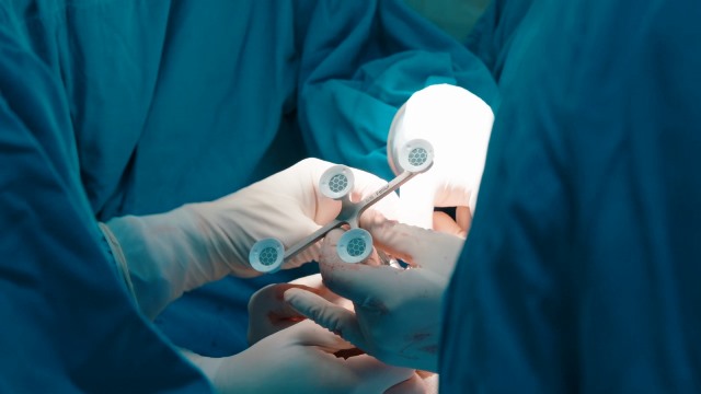 Cirurgia robótica inédita que combina tecnologia chinesa e implante nacional amplia perspectivas para o SUS